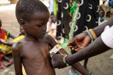 Boy having arm mass measurement taken